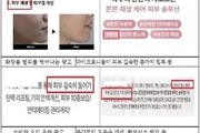마이크로니들 화장품 ‘허위·과대광고’ 82건 적발