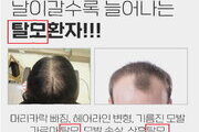 탈모 치료·예방 '온라인 과대광고' 무더기 적발