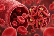 “뇌가 숨이 막힌다”…빈혈, 치매 스위치 될 수 있다