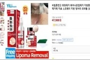'쥐젖 제거' 불법 인터넷 유통·판매 569건 적발